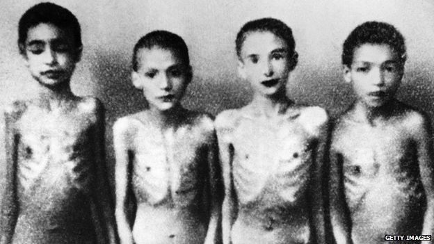 'Bác sĩ tử thần' của Đức Quốc xã và thí nghiệm trẻ song sinh