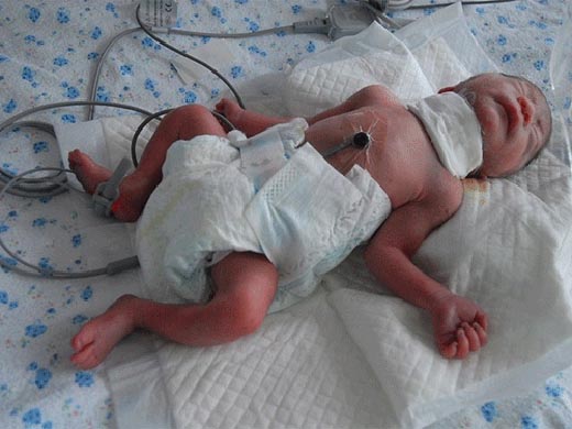 Bé sơ sinh bị cắt cổ vứt vào thùng rác ở Trung Quốc