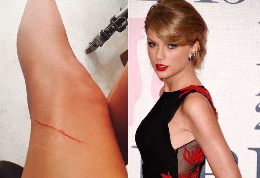 Taylor Swift bị mèo cưng cào rách 'đôi chân 850 tỷ đồng'
