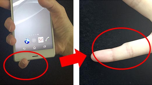 Ngón tay út bị biến dạng nếu dùng smartphone quá nhiều?
