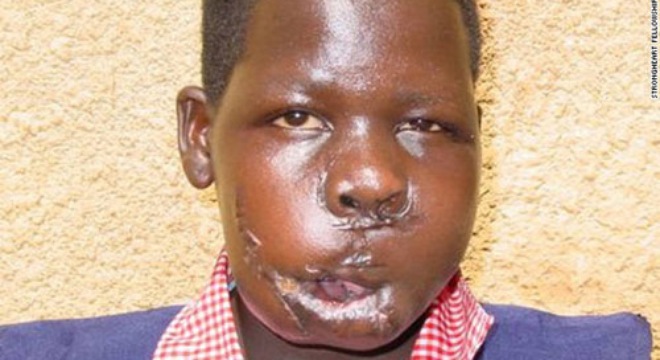 Ám ảnh kinh hoàng của thiếu nữ Uganda bị bắt cóc