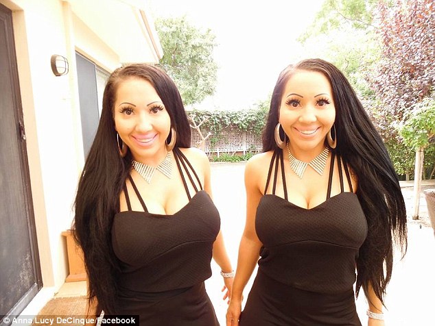 Hai chị em đi phẫu thuật thẩm mỹ để giống nhau đến 99%