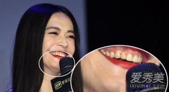 Phát hoảng trước hàm răng kinh dị của sao Hoa ngữ