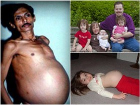 Những trường hợp mang thai "kinh dị" nhất trên thế giới