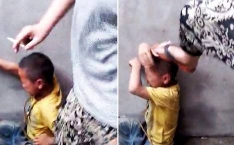 Bốn học sinh Trung Quốc bạo hành cậu bé bằng điếu thuốc