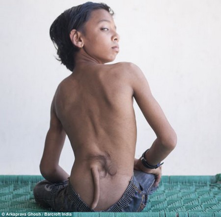 Cậu bé có đuôi được tôn thờ như thánh sống tại Ấn Độ