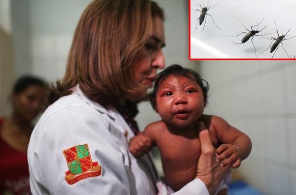 Không phải Zika mà hóa chất của Monsanto gây teo não?