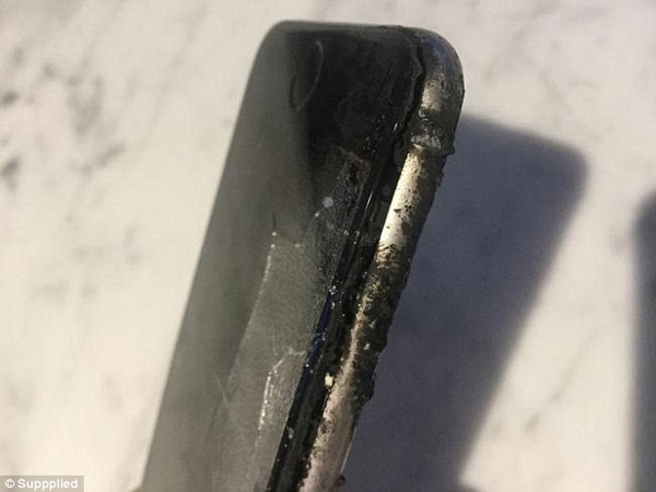iPhone 6 bất ngờ phát nổ trong túi quần khiến chủ nhân bị bỏng