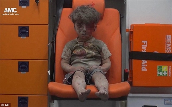 Hình ảnh cậu bé Syria bị thương làm chấn động cả thế giới