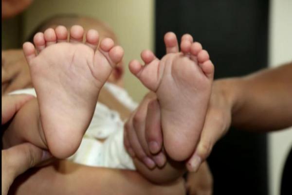 Kỳ lạ em bé có đến 31 ngón tay và chân