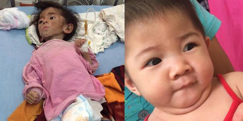 Hình ảnh mới của bé gái Lào Cai sau hơn 3 tháng được mẹ nuôi chăm sóc