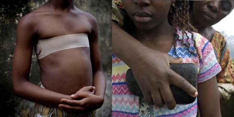 Kỳ lạ hủ tục là phẳng ngực khiến hàng triệu cô gái đớn đau tủi nhục