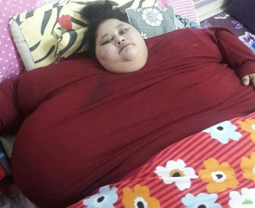 Người phụ nữ 500 kg sắp sang Ấn Độ phẫu thuật giảm cân