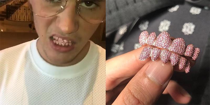 Justin Bieber chi hơn 341 triệu tậu răng giả bằng đá quý hồng lấp lánh