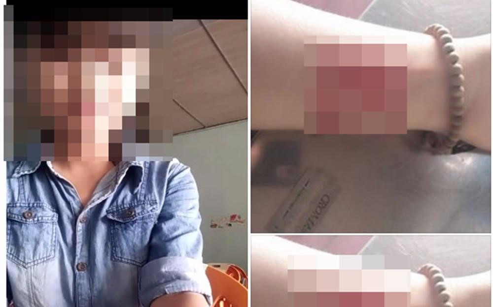 Nữ sinh 16 tuổi quay clip rạch tay để níu kéo bạn trai