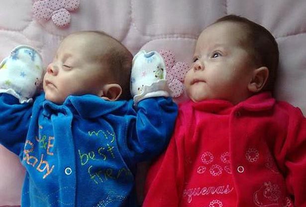 Cặp song sinh chào đời từ người mẹ chết não hơn 4 tháng