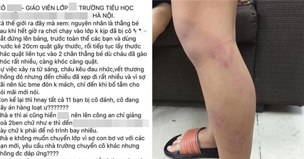 Hà Nội: 11 học sinh lớp 2 bị cô giáo đánh gãy cả thước, tím bầm chân