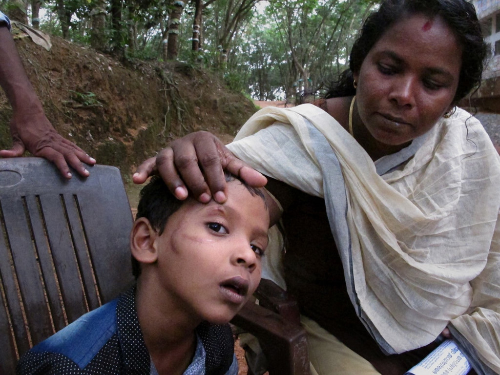 Bệnh dại ở Ấn Độ: Cuộc chiến khốc liệt không hồi kết
