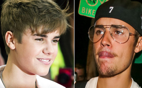 Justin Bieber: Đệ nhất mỹ nam ngày càng xấu trai, tuềnh toàng