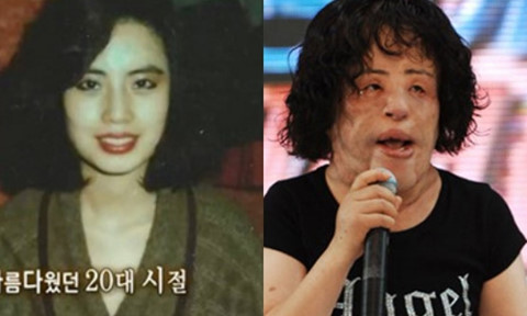 Ca sĩ mặt biến dạng vì dao kéo của Hàn Quốc qua đời ở tuổi 57