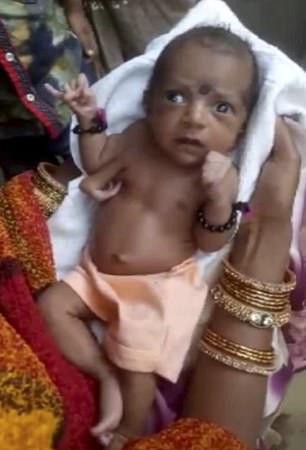Bé gái ra đời với ba bàn tay được tôn làm nữ thần ở Ấn Độ
