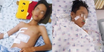 Bé trai 13 tuổi bị thanh sắt máy cắt lúa đâm xuyên ngực