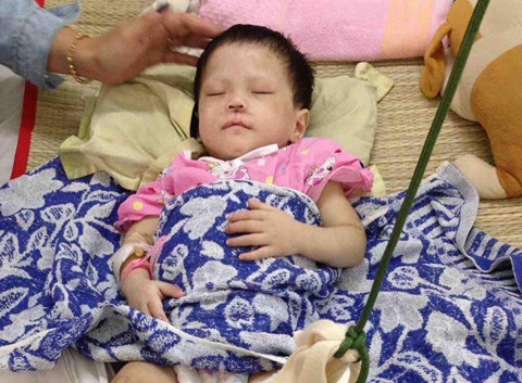 Bé gái 2 tuổi con nhà nghèo bị mẹ nuôi đánh gãy chân