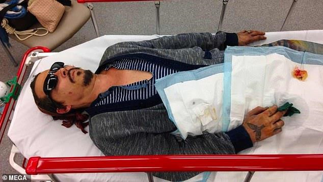 Tài tử Johnny Depp công bố ảnh nhập viện vì bị vợ cũ đánh