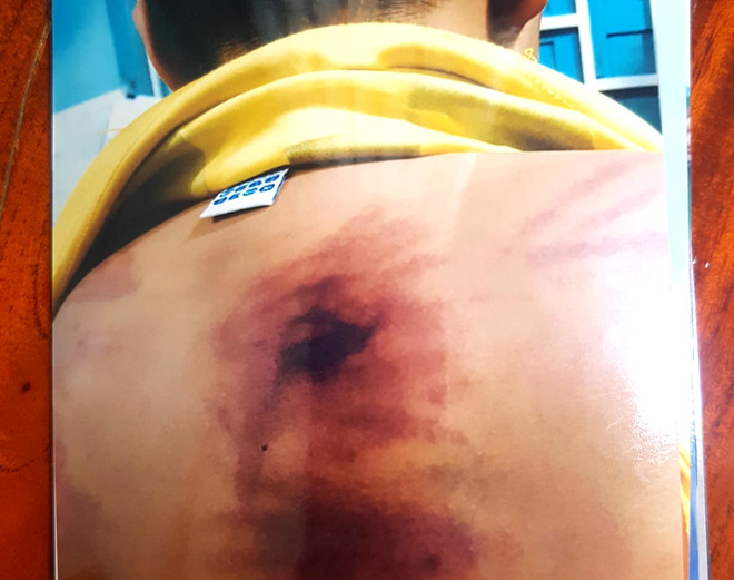 Đề nghị khởi tố cư sĩ đánh bé trai 11 tuổi ở Bình Thuận
