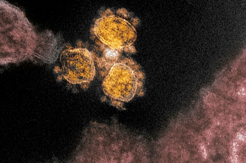Sản xuất thành công kháng thể diệt virus corona