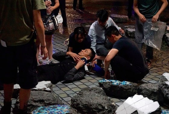 Lưu Đức Hoa bị thương trên phim trường 'Chuyên gia phá bom 2'