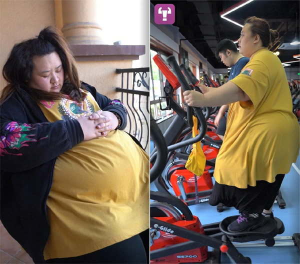 Bi kịch của cô gái Trung Quốc nặng 253 kg