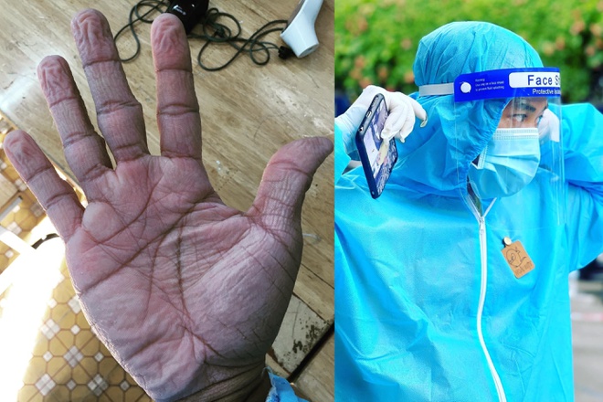 Bàn tay nhăn nheo, nứt nẻ của tình nguyện viên chống dịch ở TP.HCM