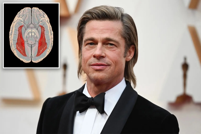 Nguy hiểm từ hội chứng mù mặt của Brad Pitt