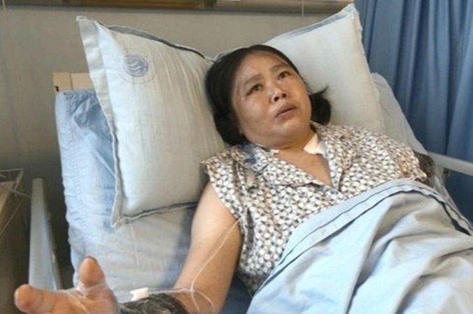 Người phụ nữ Trung Quốc mất cánh tay khi cứu bé trai khỏi xe tải