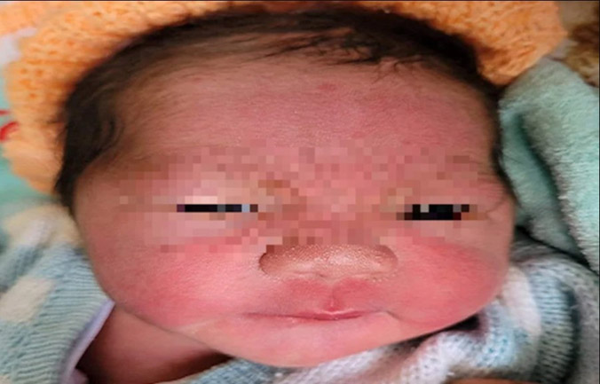 Bé trai sơ sinh nặng 3,5 kg bị bỏ rơi ở vùng thôn quê Thừa Thiên - Huế